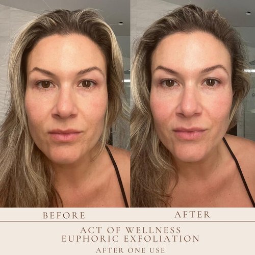 Euphoric Exfoliation Facial Peel - Weekly Treatment for Soft, Smooth Skin | Vegan Lactic & Glycolic Acid (2oz & 1oz)