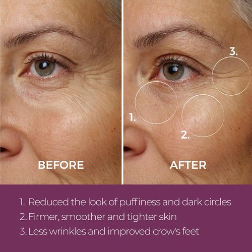 Blinc Eye Repair Peptide Complex - Vegan Anti-Aging Eye Cream | Reduces Fine Lines & Dark Circles | 15 g / 0.53 oz