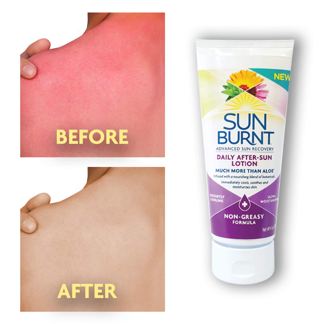 Sunburnt Advanced After-Sun Lotion - Soothing Relief for Sun-Damaged Skin | 6 Ounce