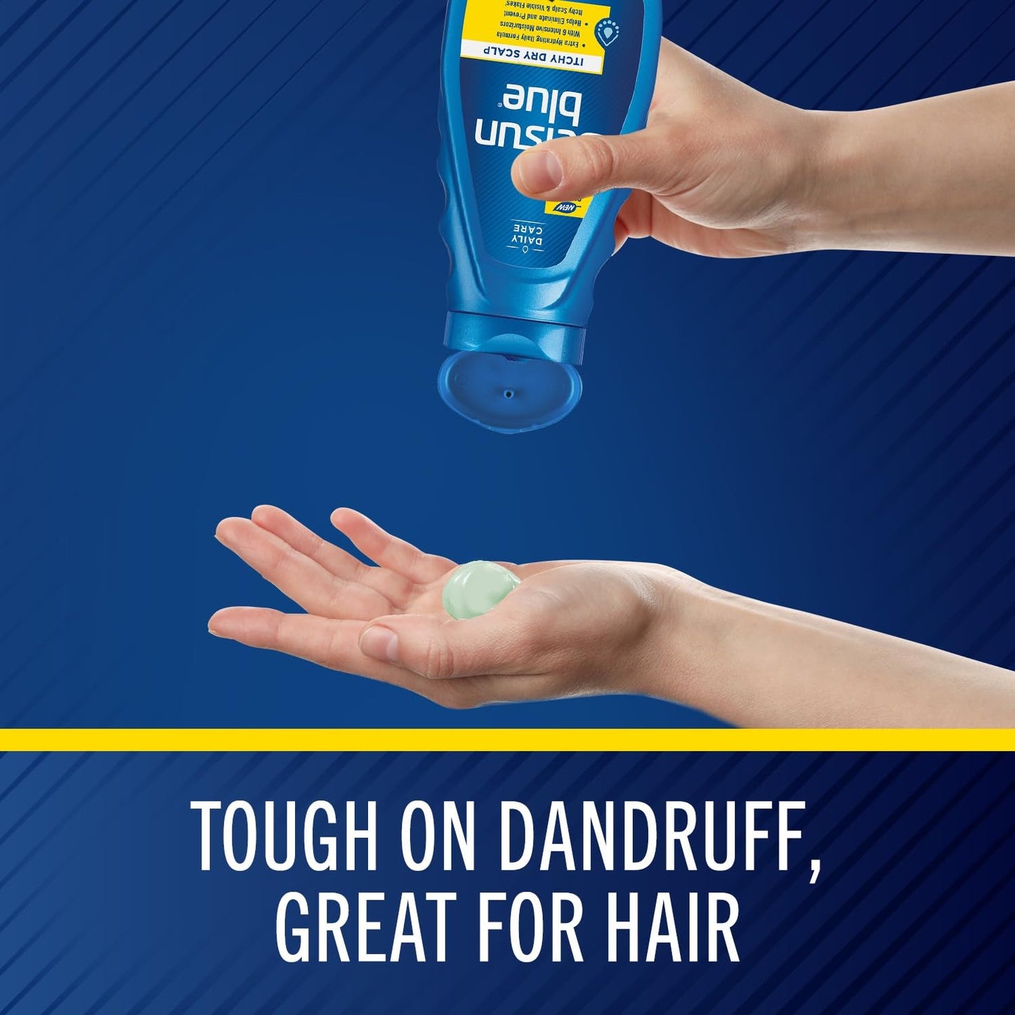 Selsun Blue Anti-Dandruff Shampoo - Extra Hydrating Formula with Pyrithione Zinc 1% | 11 fl. oz.