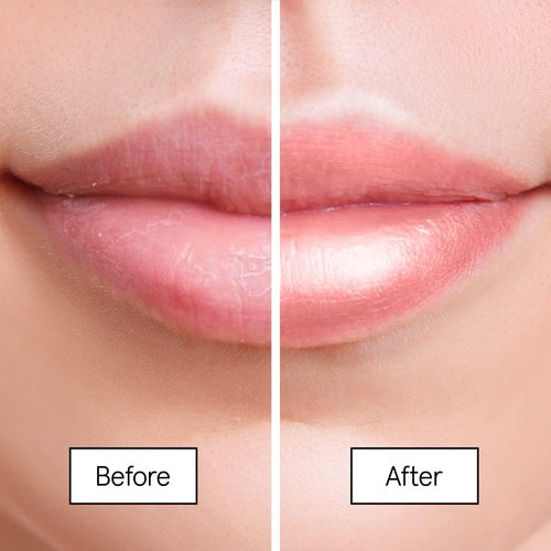 Grace & Stella Award Winning Lip Plumper Nourishing Berry Lip Mask - Lip Balm Hydrating - Lip Moisturizer For Very Dry Lips - Overnight Lip Mask & Lip Treatment & Lip Sleeping Mask - Vegan