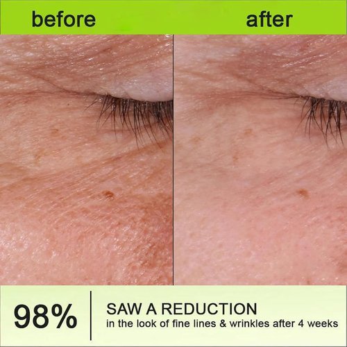 1 Packs Botoxmix & Vita-A Retinol Shot Wrinkle-Lift Tightening Cream, Anti Wrinkle, Pore Minimizer, Fine Lines, All Skin