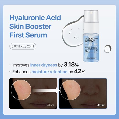 Meditherapy Gentle Boost Kit – Korean Skin Care Set with Retinal & Hyaluronic Acid Serum & Squalane Moisturizer, Anti-Aging & Hydrating Routine, Beginner-Friendly, Travel & Gift