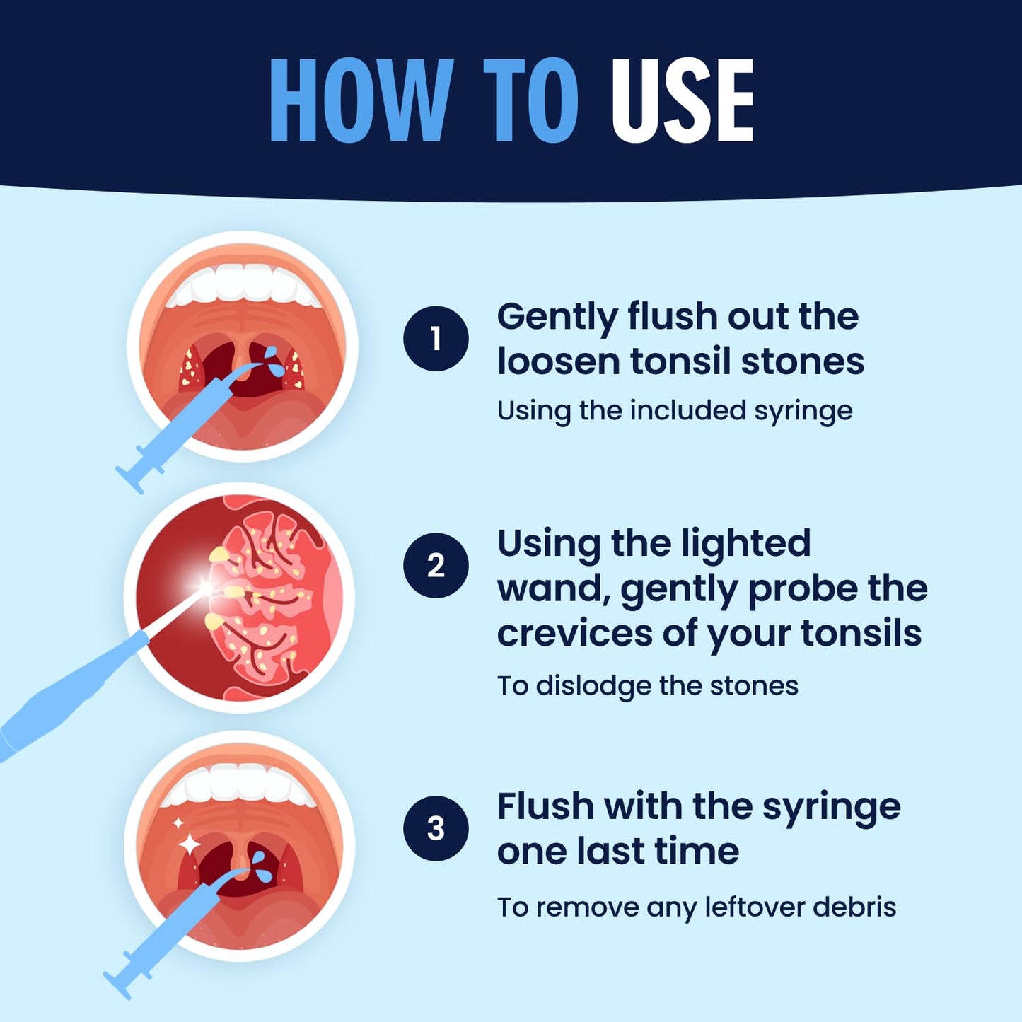Dr. Frederick’s Original Easy Tonsil Stone Remover Kit - Fast Painless Tonsillolith Removal Tool - Fight Bad Breath - Pick and Oral Irrigator - 8 Pieces