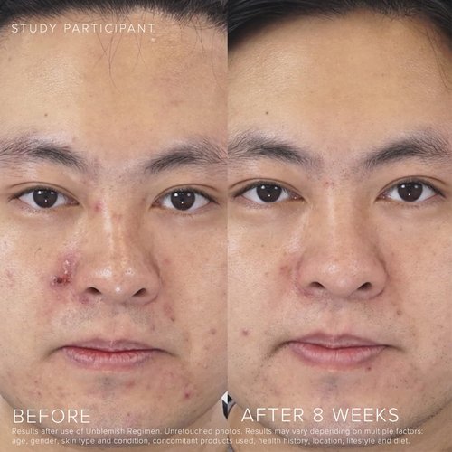 Rodan + Fields UNBLEMISH Invisible Matte Defense SPF 30 - Broad Spectrum Sunscreen Moisturizer for Face & Neck