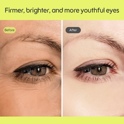 Kiero Pure Radiant Eye Cream - Lightweight, Fast-Absorbing Formula for Puffiness & Dark Circles - Vegan Moisturizer with Niacinamide (0.85 fl oz)