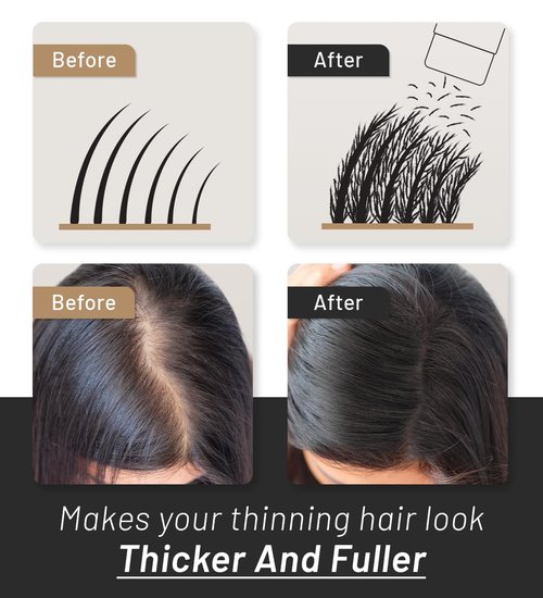 CONFIERR Hair Fibers for Men & Women (30 Grams, White), Fill In Fine or Thinning Hair, Instantly Thicker, Fuller Looking Hair