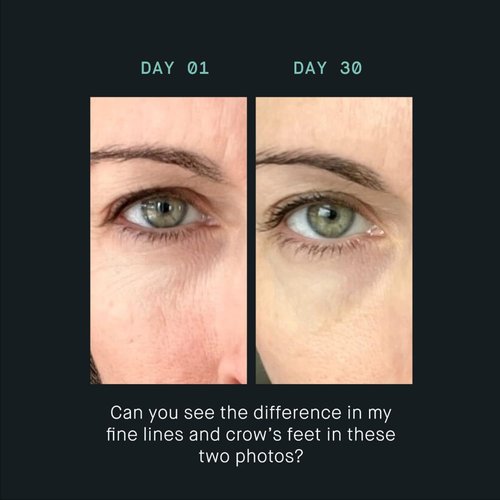 OneSkin EYE OS-01 Peptide Eye Cream - Age Reversal & Skin Longevity | Fragrance-Free, Sensitive Skin Safe