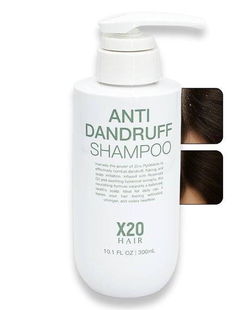 Regine Switzerland Anti-Dandruff Shampoo - Sulfate-Free Scalp Care for Flaky & Oily Scalp - 1% Zinc Pyrithione, Botanical Formula