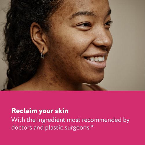 ScarAway Acne Scar Treatment, Clear Silicone Scar Gel, 100% Medical-Grade, Helps Improve Size, Color & Texture of Post-Acne Hypertrophic & Keloid Scars on Face & Body, Water Resistant, 15 grams