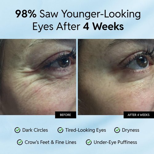 Regine Switzerland Anti-Aging Eye Cream - Smooths Wrinkles & Hydrates - Fast-Absorbing, 15ml