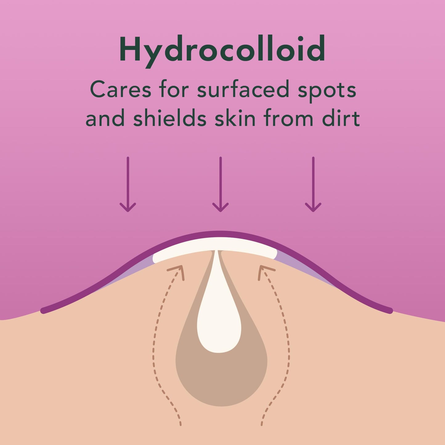 Rael Pimple Patches, Miracle Invisible Spot Cover - Hydrocolloid Acne Pimple Patch, Absorbs Zits & Blemish, Korean Skin Care, 2 Sizes (96 Count)