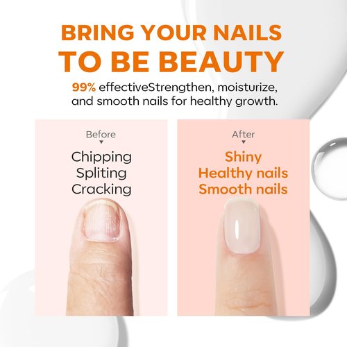 modelones Nail Strengthener and Growth Nail Polish Nail Repair for Damaged Nails Strengthening Polish Gel Ridge Filler for Nails 15ml for Nail Art