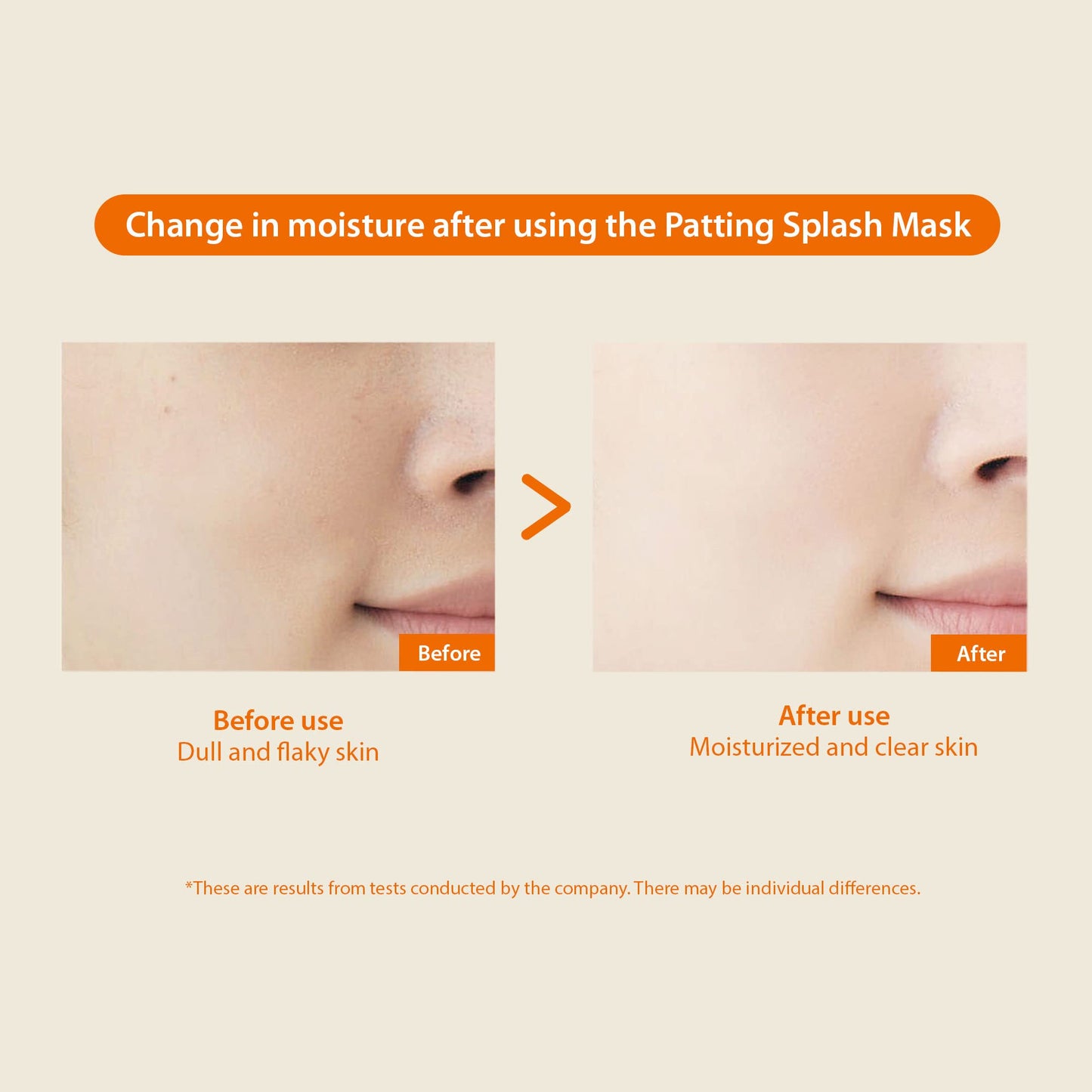 BLITHE Patting Splash Mask Exfoliating Face Wash with Yellow Honey - Korean Chemical Exfoliant for Face AHA Lactic Acid for Dark Spots, Energy Citrus for Skin Brightening & Radiance 5.07 Fl Oz