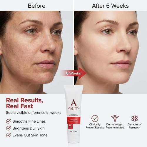 Alpha Skin Care Enhanced Renewal Cream - Anti-Aging 12% Glycolic AHA for Lines & Wrinkles | 2 Oz