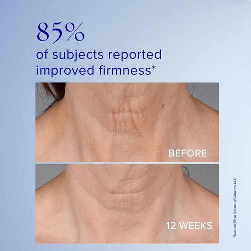iS CLINICAL Neckperfect Complex - Firming Anti-Aging Neck Cream for Tightening & Lifting