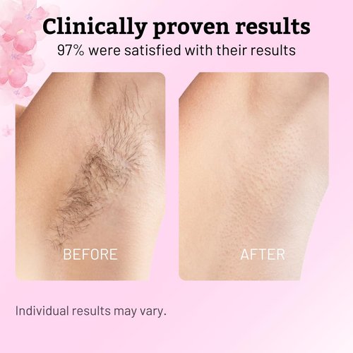 Cyperus Rotundus Oil - 60ml Natural Hair Removal & Moisturizing Oil | Soothes & Reduces Body Hair Growth