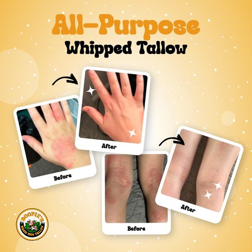 Magic Moo Whipped Beef Tallow Skincare - Organic Moisturizer for Acne, Eczema & Dry Skin | 4oz