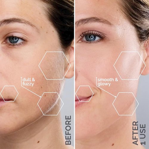 Michael Todd Beauty Sonicsmooth Dermaplane Razor - Women's Face & Eyebrow Trimmer | 8 Weeks of Blades for Peach Fuzz Removal
