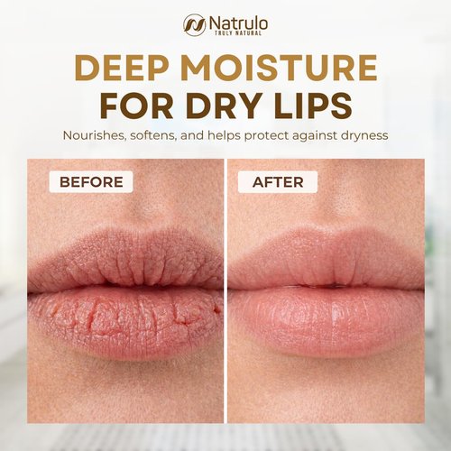 Coconut Lip Balm - Hydrating Natural Chapstick with Coconut Oil & Beeswax for Dry Cracked Lips - Made in USA