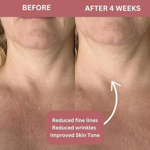 CocoBeauty Bio-Collagen Neck Mask - Hydrogel Firming & Tightening Patches for Anti-Aging (4 Pcs)