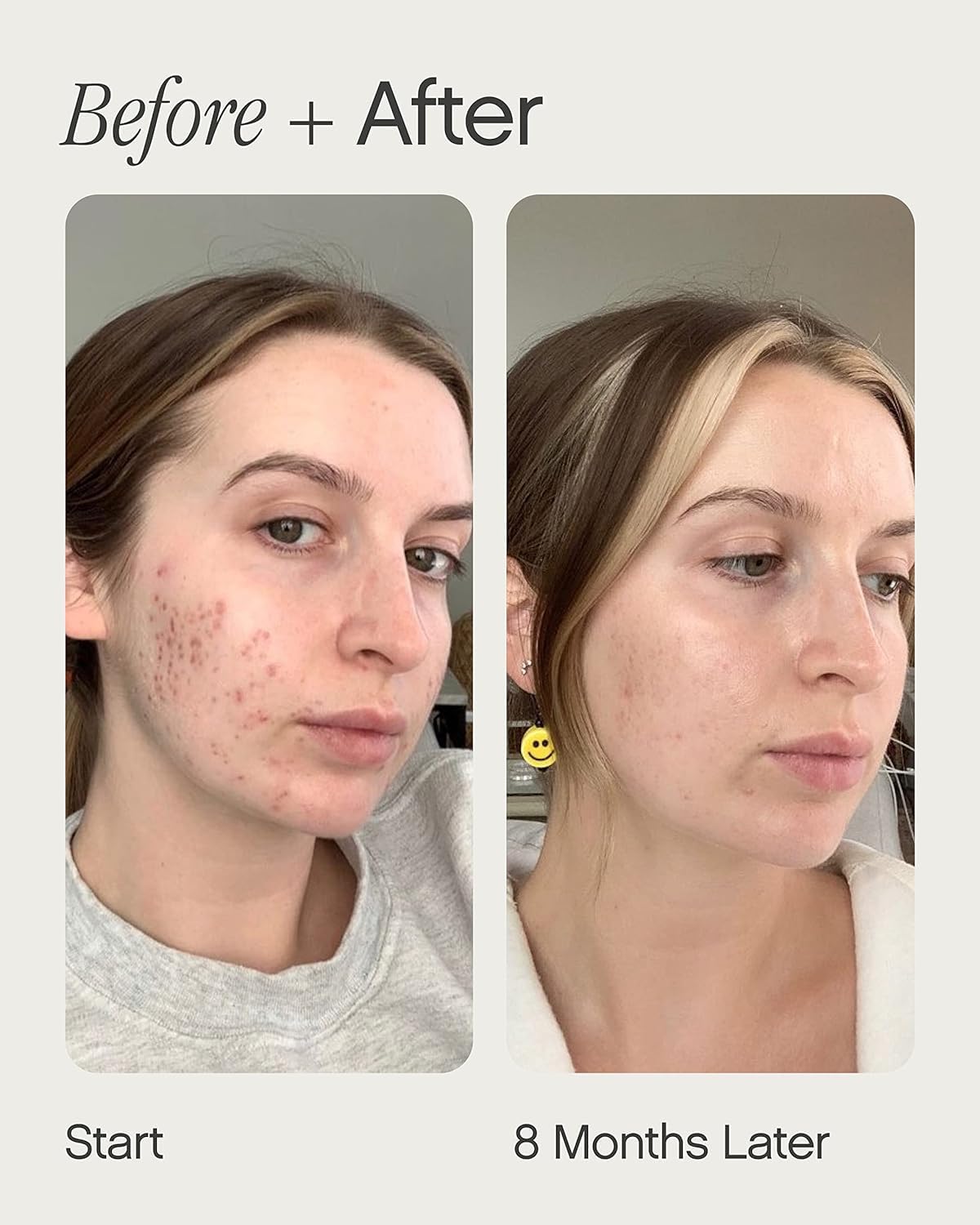 Topicals Faded Brightening Serum - Reduces Discoloration & Scars | Kojic Acid & Niacinamide | 0.5 Fl Oz