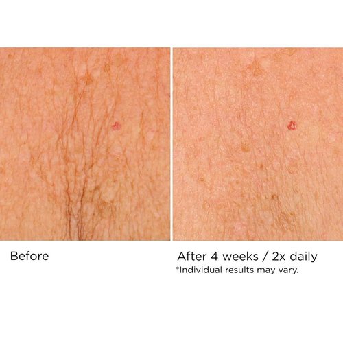 NassifMD Neck & Decollete Firming Complex - Lifting Treatment for Youthful Skin