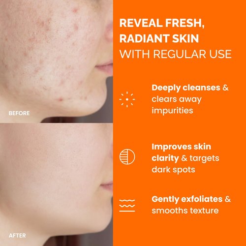 PLANTIFIQUE Kojic Acid & Turmeric Cleansing Pads - 60 Exfoliating Facial Pads for Radiant Skin