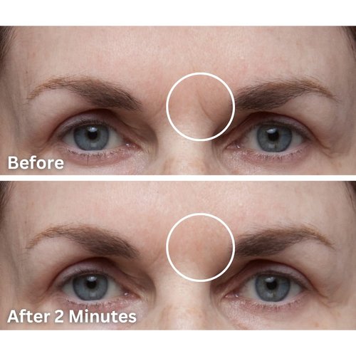 Dermaflage Scar Filler - Refill Applicator for Flawless Skin | Easy Application