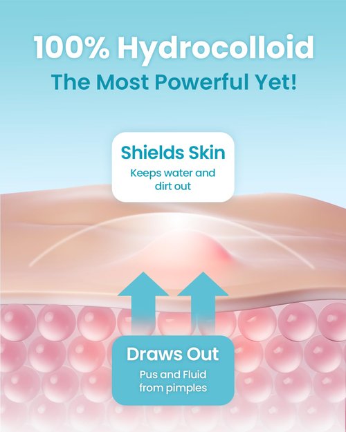 GLAM UP Hydrocolloid Blemish Pimple Patches - Invisible Ultra-Thin Spot Covers, Waterproof & Adhesive (36 Count)