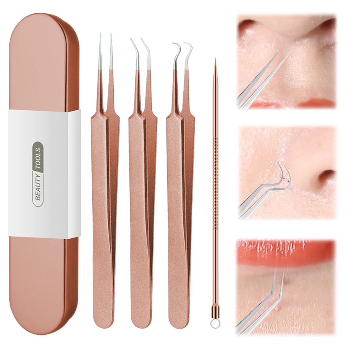 xwxwseui Usiveinborn Blackhead Remover Upgraded, Usiveinborn Blackhead Tweezers, Professional Upgraded Facial Blackhead Remover Tweezers, Blackhead Remover Tools Sets (A5-Rose-Gold-4pcs)
