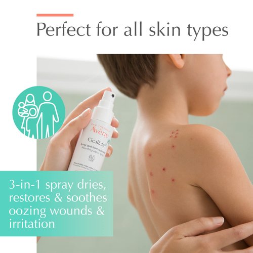 Avène Cicalfate+ Soothing Spray - Absorbs & Restores Irritated Skin | Safe for All Ages