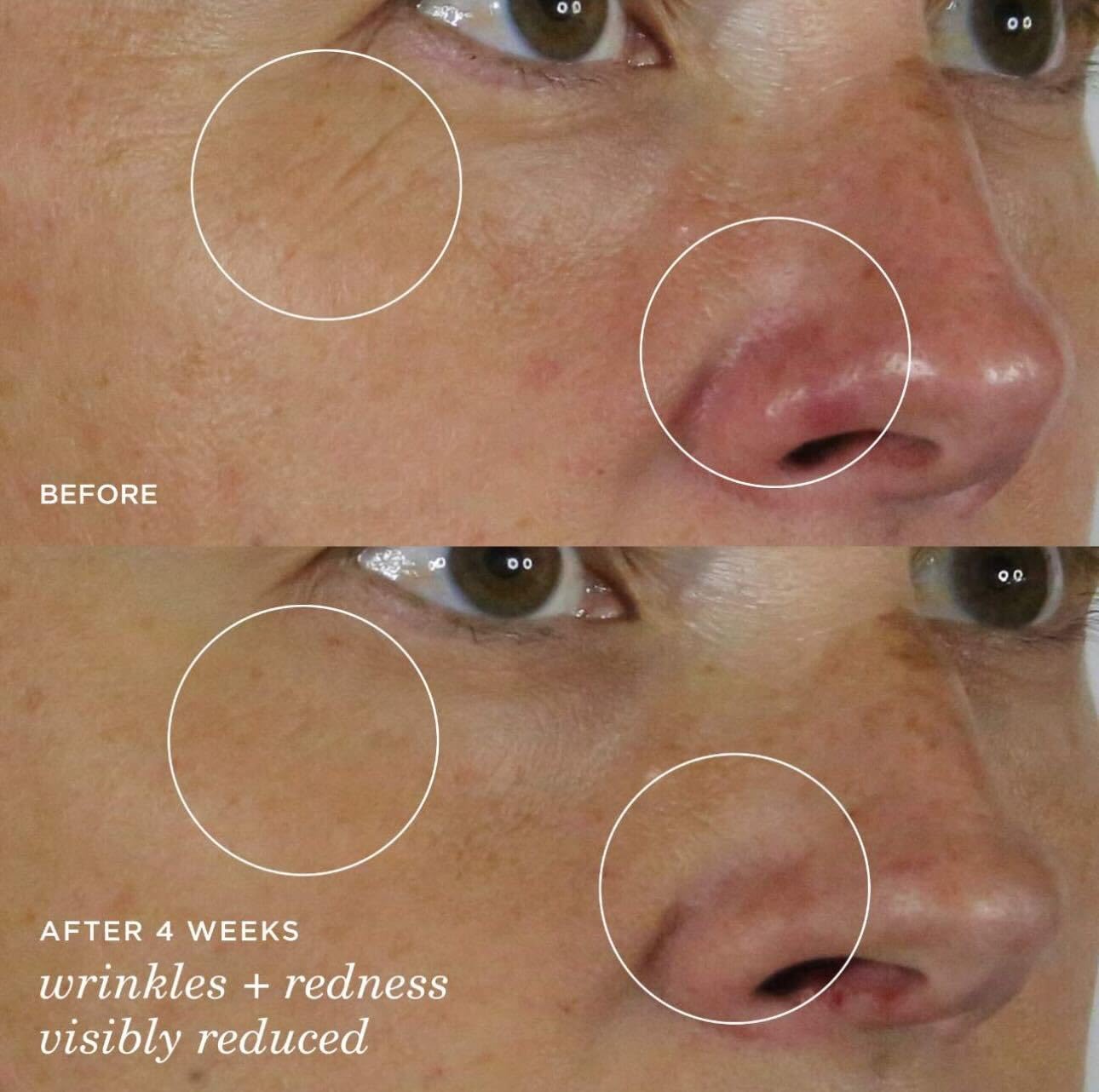 Tatcha Silk Serum - Wrinkle-Smoothing Retinol Alternative | 30 ml / 1 oz