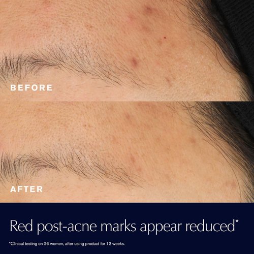 Estée Lauder Advanced Night Repair - 15% Bifidus Ferment Solution to Reduce Redness | 0.68 Fl Oz