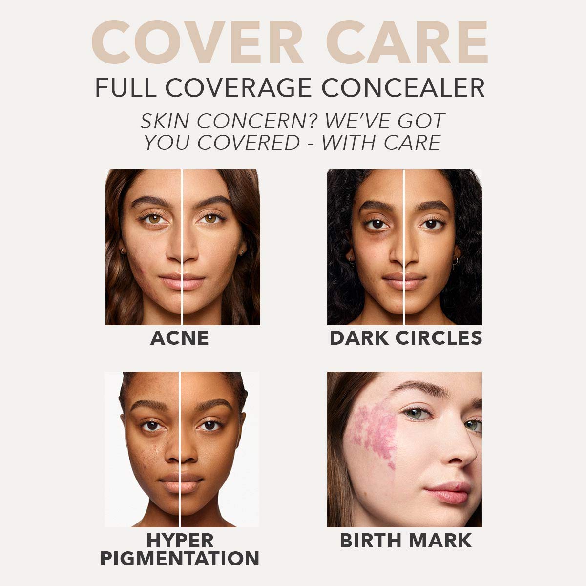 Dermablend Cover Care Concealer - Full Coverage Makeup for Dark Circles, Acne & Blemishes