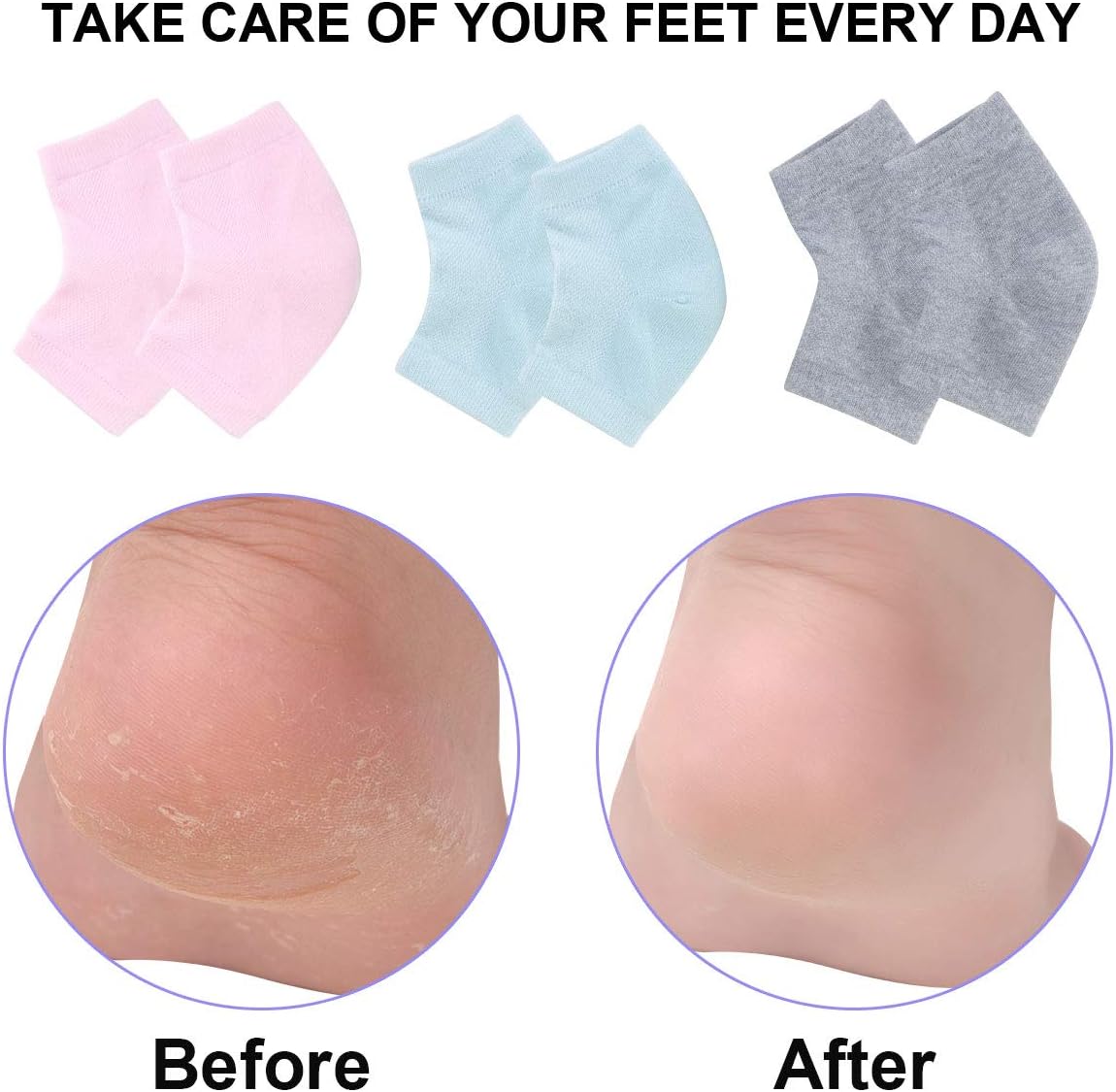 Skiennix Vented Moisturizing Gel Heel Socks - 3 Pairs Toeless Spa Socks for Cracked Heels & Dry Feet | Gray, Green, Pink