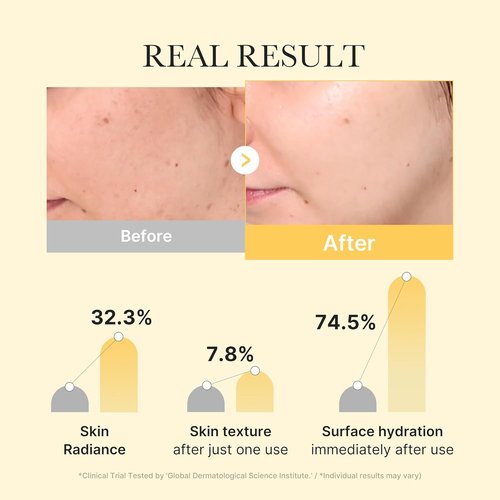 Medicube Jelly Gel Mask - Brightening Kojic Acid & Turmeric | Overnight Hydrating Face Mask | 28g x 4ea