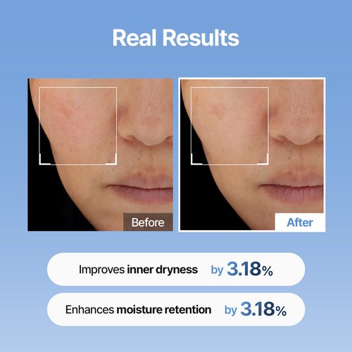 Meditherapy Hyaluronic Acid Serum - Ultra Hydrating Face Moisturizer | 150ml for Glowing Skin & Anti-Aging