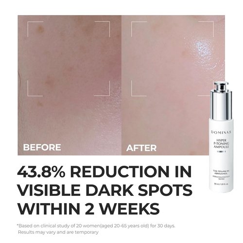 **DOMINAS 10% TXA Hyper P-Toning Serum - Brightening & Discoloration Correcting with 5% AHA & Niacinamide | 1.01 fl oz**