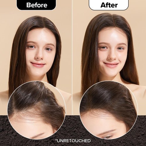 I DEW CARE Biotin Clarifying Dry Shampoo - Strengthening & Volumizing Powder for Dark Brown Hair | Travel Size 0.24 Oz