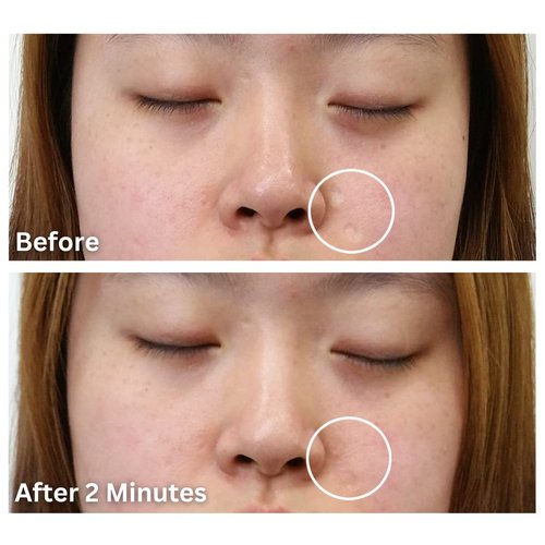Dermaflage Scar Filler - Refill Applicator for Flawless Skin | Easy Application