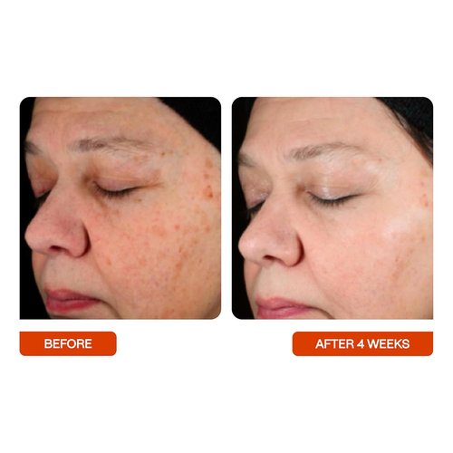 BeautyStat Universal C Skin Refiner - 20% Vitamin C Serum for Radiant Skin | 30ml / 1.0 oz