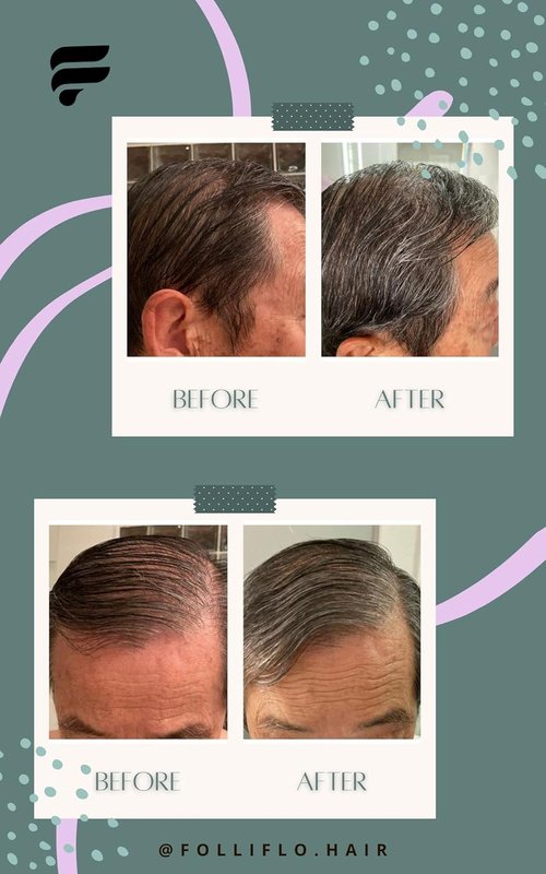 Folliflo Hair Boost Leave-In Conditioner Spray - Thicker-Looking Hair & Scalp Care | Lightweight Daily Formula, 90-Day Supply