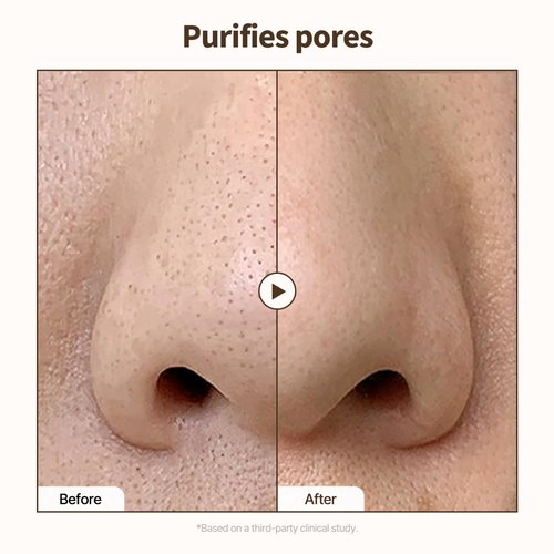 PONGDANG Vita Toning Serum - Pore-Refining & Skin-Brightening | Lightweight Formula with 12 Vitamins & Niacinamide