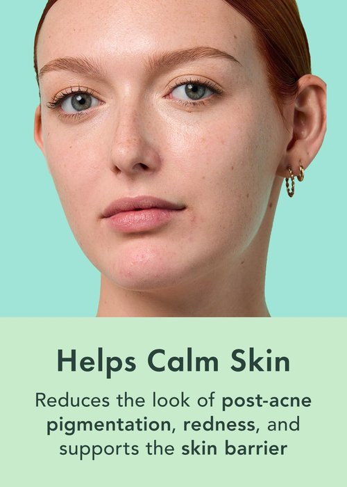 Rael Miracle Clear Serum - Salicylic Acid & Niacinamide Pore Minimizer | Korean Skin Care (1 fl oz)