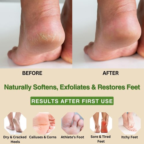 Natural Escapes Foot Cream - Peppermint, Rosemary & Eucalyptus for Dry Cracked Heels | Moisturizing 4 oz