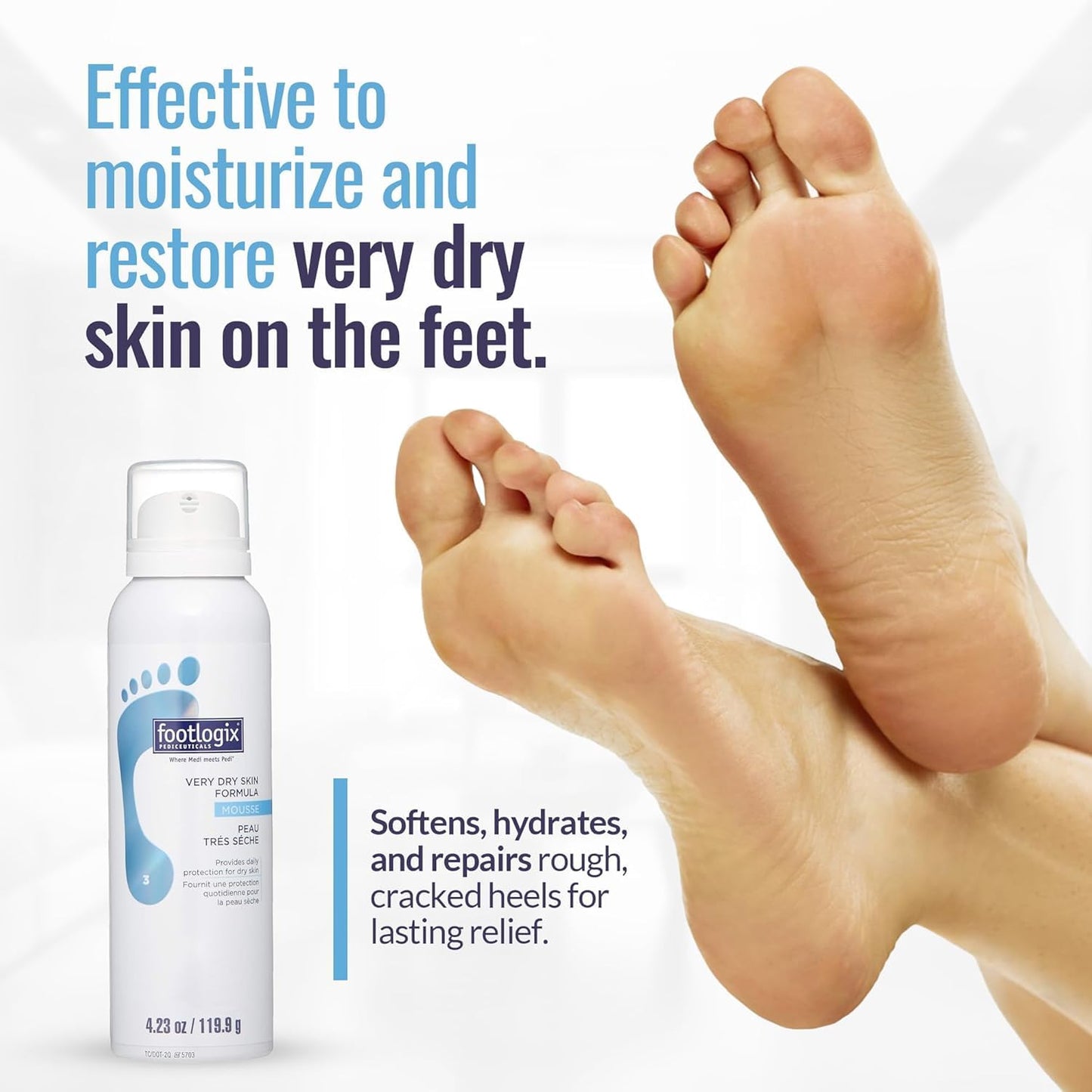 Footlogix Very Dry Skin Formula - Intensive Moisturizer for Dry Feet | 4 oz