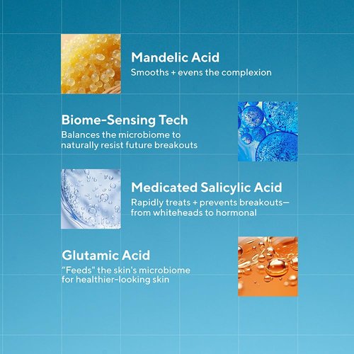 Murad Biome-Balancing Acne Treatment Serum - Salicylic, Mandelic & Glutamic Acid for Clear Skin | 1.0 Fl Oz