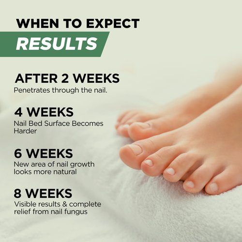 Foot Cure Toenail Fungus Treatment - Extra Strength Nail Repair with Tea Tree & Oregano Oil | Made in USA