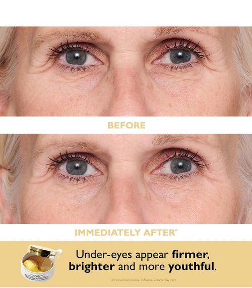 Peter Thomas Roth | Travel Pack Eye Patches for Instant Hydration & Brightening